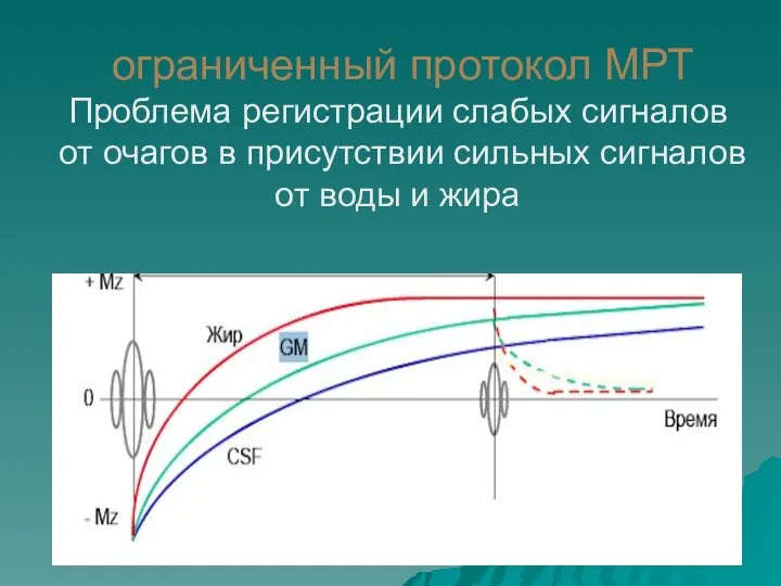 ограниченный протокол МРТ Проблема регистрации слабых сигналов от очагов в присутствии