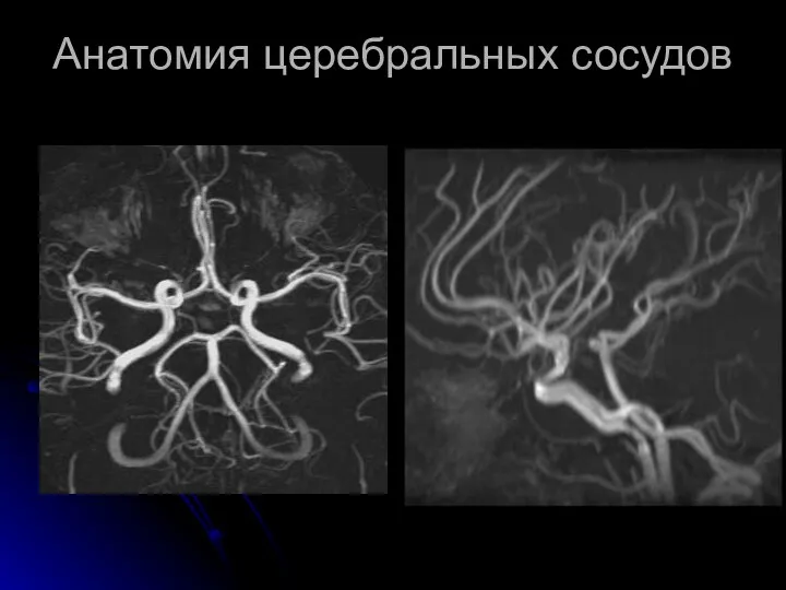 Анатомия церебральных сосудов