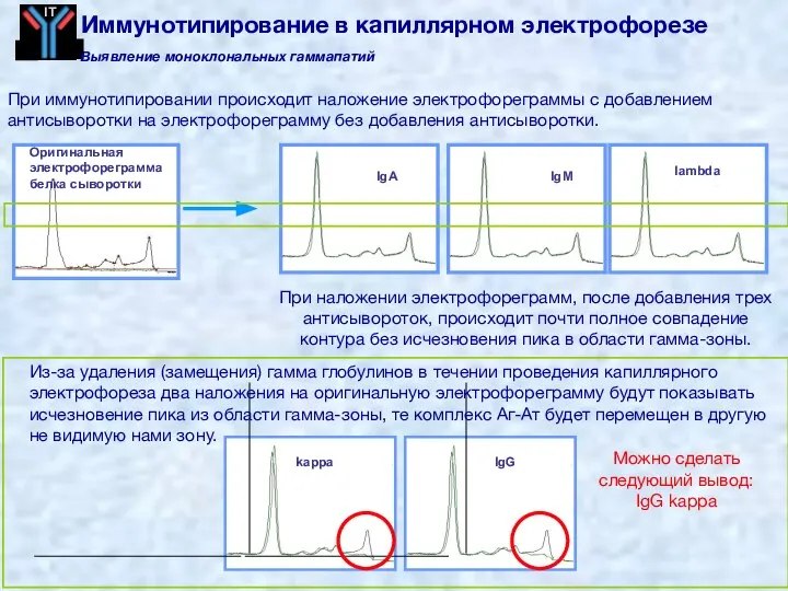 IgG IgA IgM lambda Оригинальная электрофореграмма белка сыворотки kappa Можно сделать