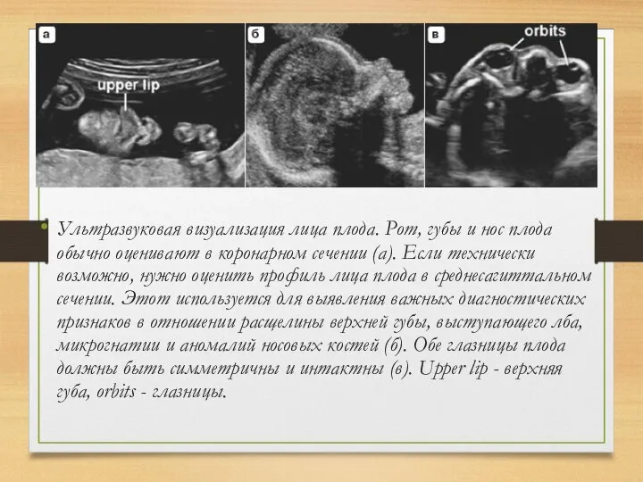 Ультразвуковая визуализация лица плода. Рот, губы и нос плода обычно оценивают