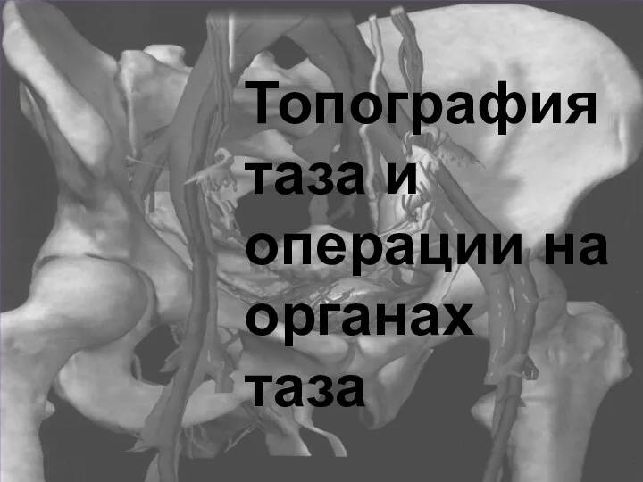 Топография таза и операции на органах таза Топография таза и операции на органах таза