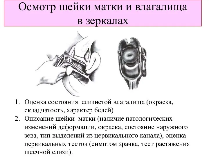 Осмотр шейки матки и влагалища в зеркалах Оценка состояния слизистой влагалища