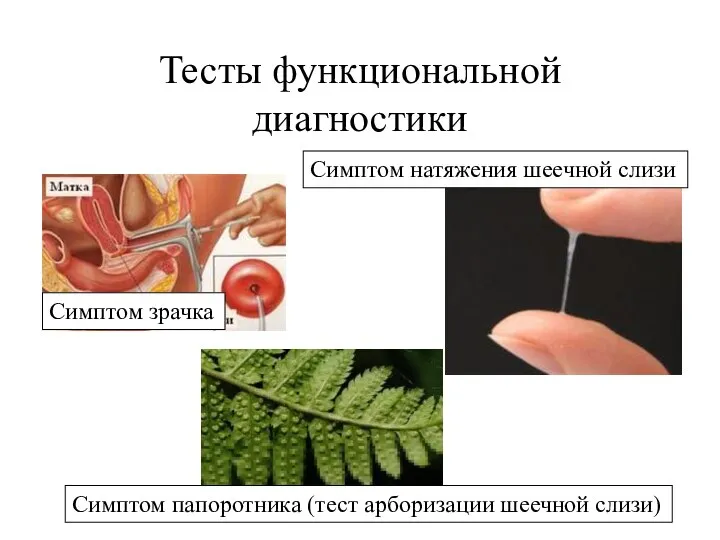 Тесты функциональной диагностики Симптом зрачка Симптом натяжения шеечной слизи Симптом папоротника (тест арборизации шеечной слизи)