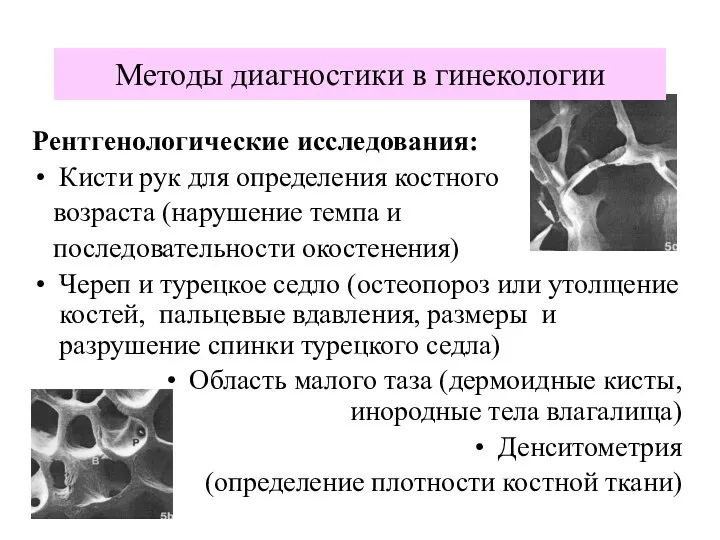 Рентгенологические исследования: Кисти рук для определения костного возраста (нарушение темпа и