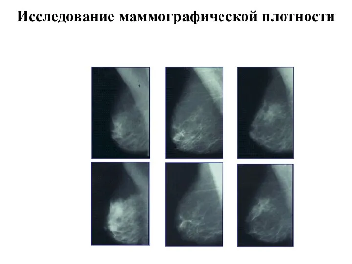 E2/NETA Тиболон Плацебо До лечения Через шесть месяцев лечения Исследование маммографической