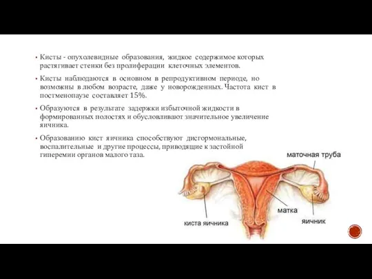 Кисты - опухолевидные образования, жидкое содержимое которых растягивает стенки без пролиферации