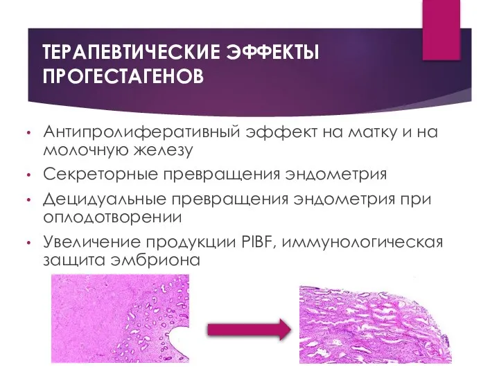 ТЕРАПЕВТИЧЕСКИЕ ЭФФЕКТЫ ПРОГЕСТАГЕНОВ Антипролиферативный эффект на матку и на молочную железу