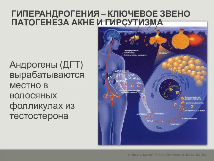 ГИПЕРАНДРОГЕНИЯ – КЛЮЧЕВОЕ ЗВЕНО ПАТОГЕНЕЗА АКНЕ И ГИРСУТИЗМА Williams C, Layton