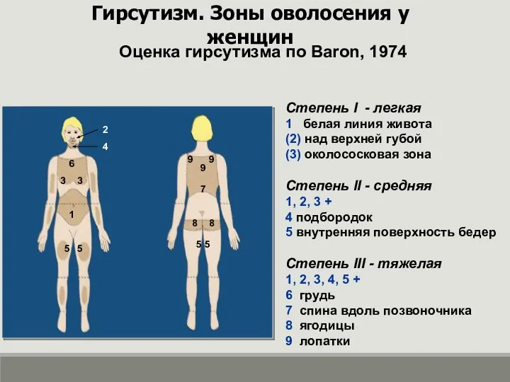 Гирсутизм. Зоны оволосения у женщин Оценка гирсутизма по Baron, 1974 Степень