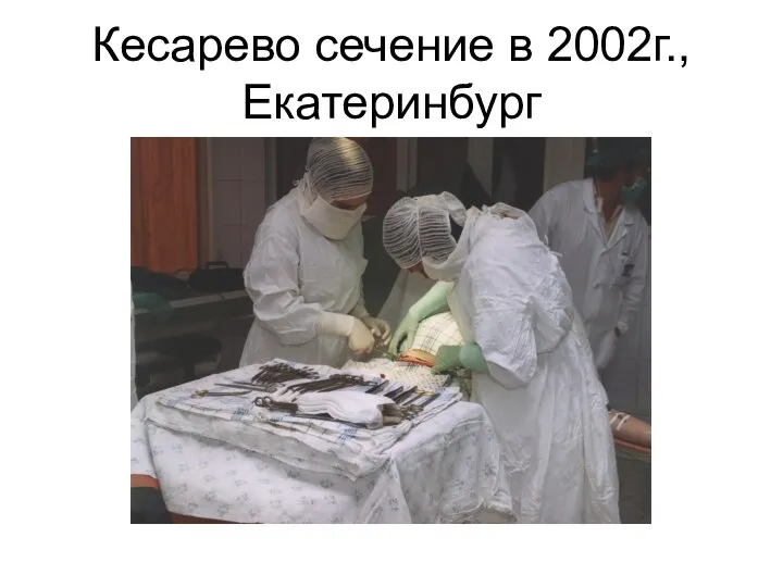 Кесарево сечение в 2002г., Екатеринбург