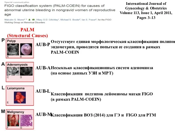 AUB-P AUB-A AUB-L AUB-M PALM (Structural Causes) International Journal of Gynecology