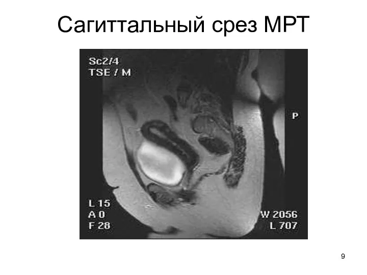 Сагиттальный срез МРТ