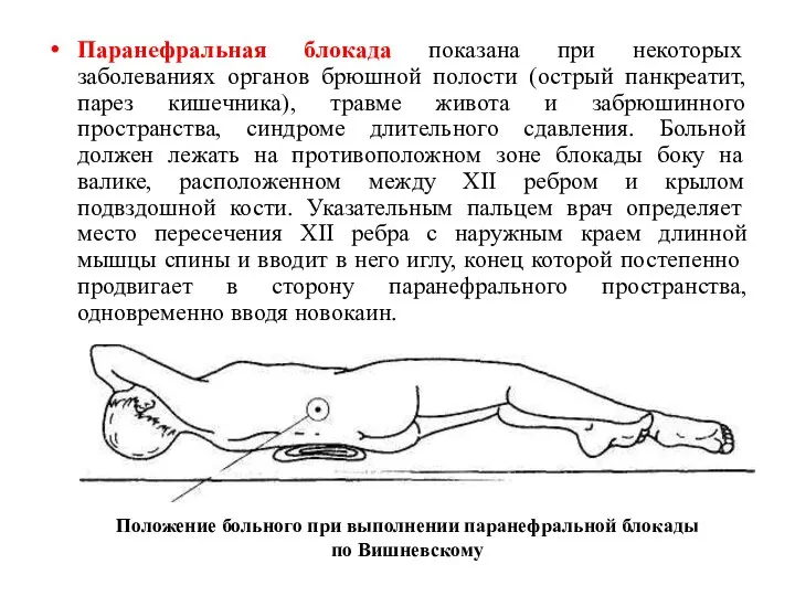 Паранефральная блокада показана при некоторых заболеваниях органов брюшной полости (острый панкреатит,