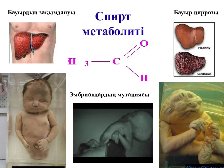 Спирт метаболиті Бауырдың зақымдануы Бауыр циррозы Эмбриондардың мутациясы