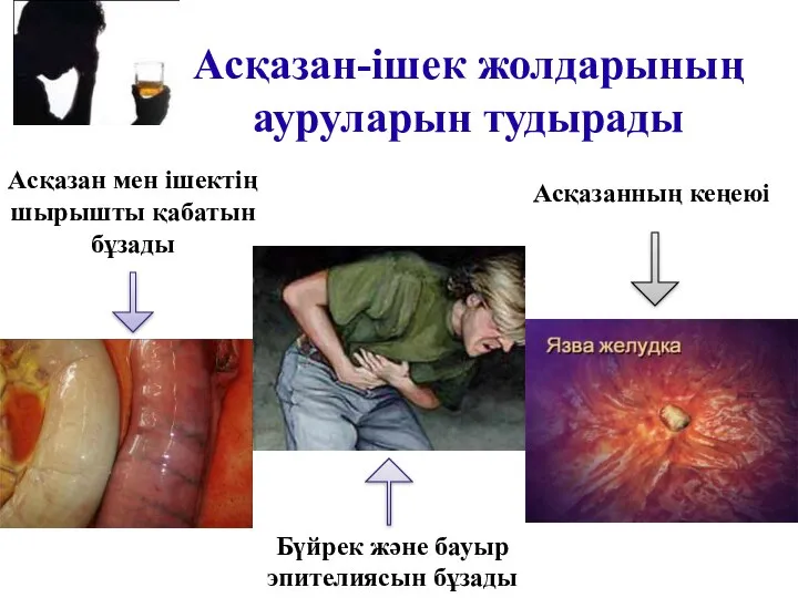 Асқазан-ішек жолдарының ауруларын тудырады Асқазанның кеңеюі Асқазан мен ішектің шырышты қабатын