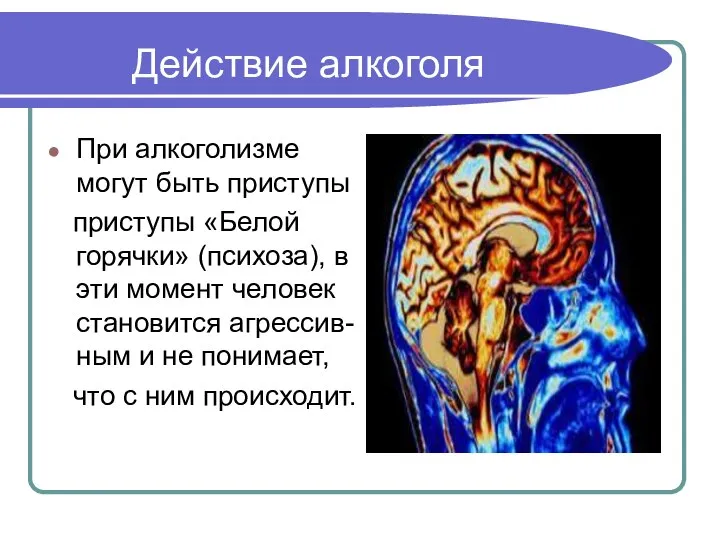 Действие алкоголя При алкоголизме могут быть приступы приступы «Белой горячки» (психоза),