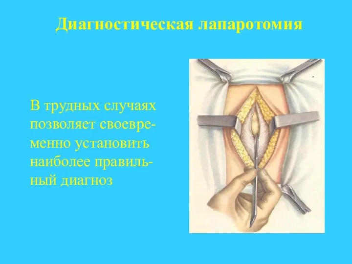 Диагностическая лапаротомия В трудных случаях позволяет своевре-менно установить наиболее правиль-ный диагноз