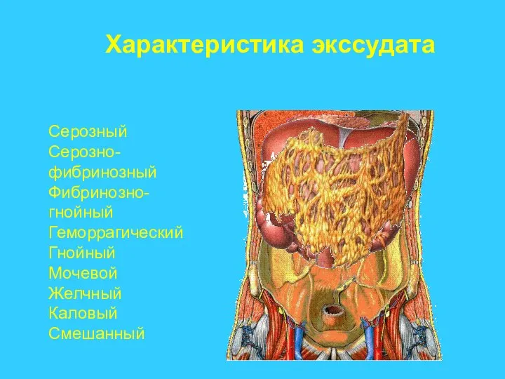 Характеристика экссудата Серозный Серозно-фибринозный Фибринозно-гнойный Геморрагический Гнойный Мочевой Желчный Каловый Смешанный