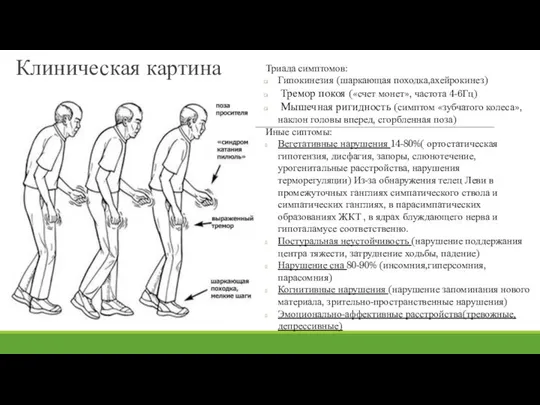 Клиническая картина Триада симптомов: Гипокинезия (шаркающая походка,ахейрокинез) Тремор покоя («счет монет»,