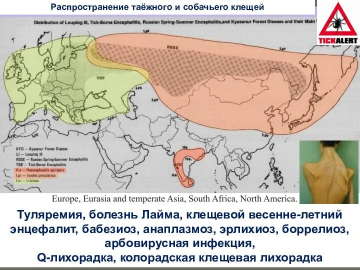 Туляремия, болезнь Лайма, клещевой весенне-летний энцефалит, бабезиоз, анаплазмоз, эрлихиоз, боррелиоз, арбовирусная