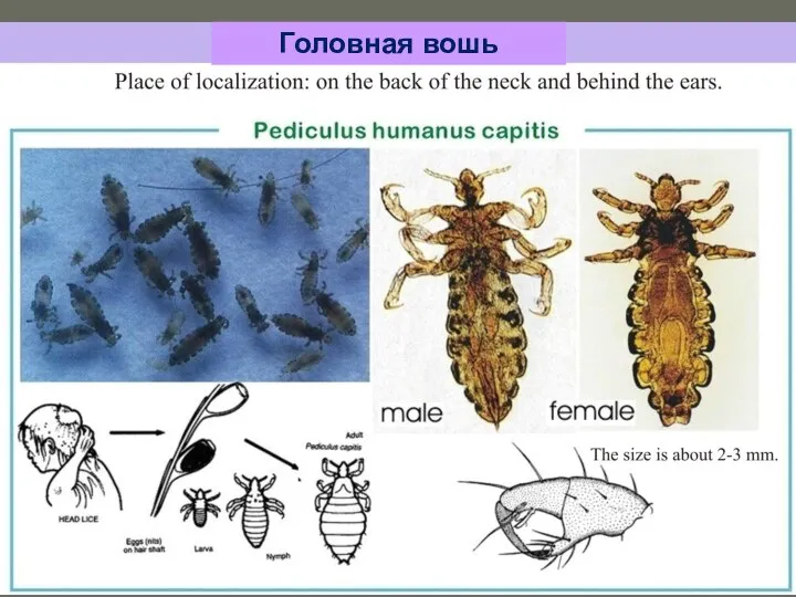 Головная вошь