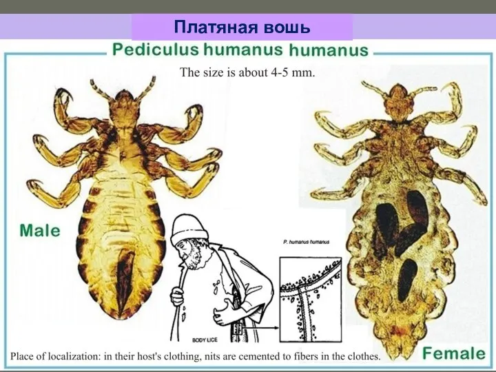 Платяная вошь