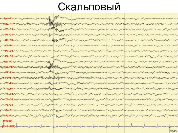 Скальповый