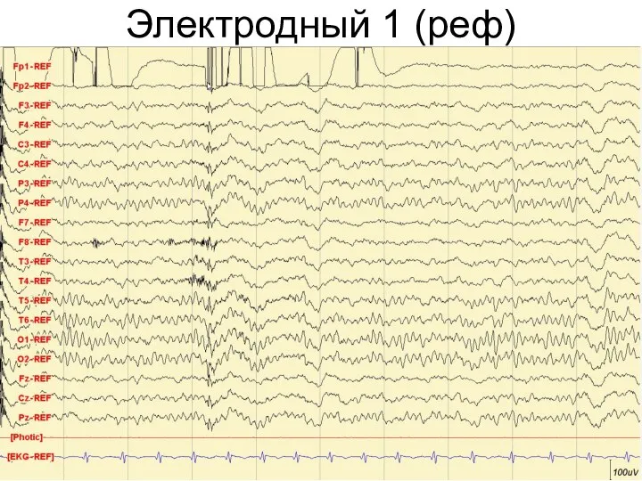 Электродный 1 (реф)