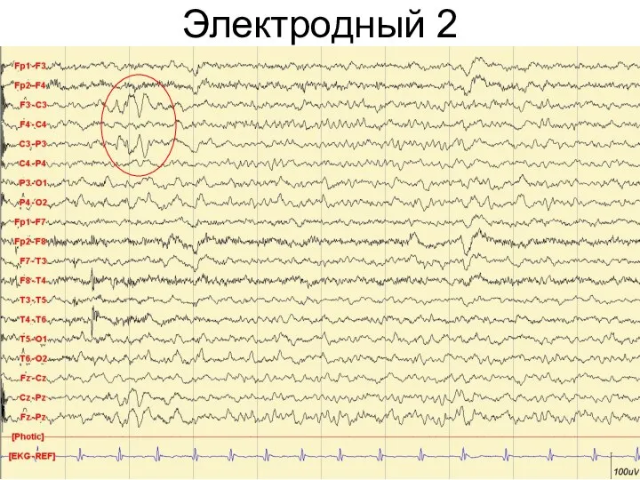 Электродный 2