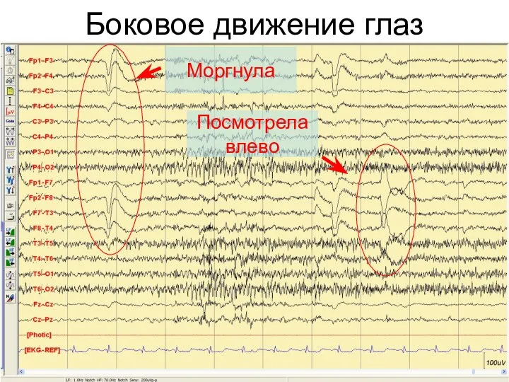 Боковое движение глаз Посмотрела влево Моргнула