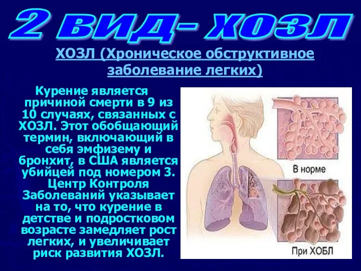 Курение является причиной смерти в 9 из 10 случаях, связанных с