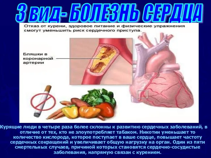 Курящие люди в четыре раза более склонны к развитию сердечных заболеваний,