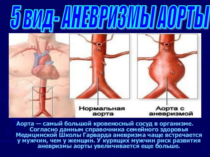 Аорта — самый большой кровеносный сосуд в организме. Согласно данным справочника