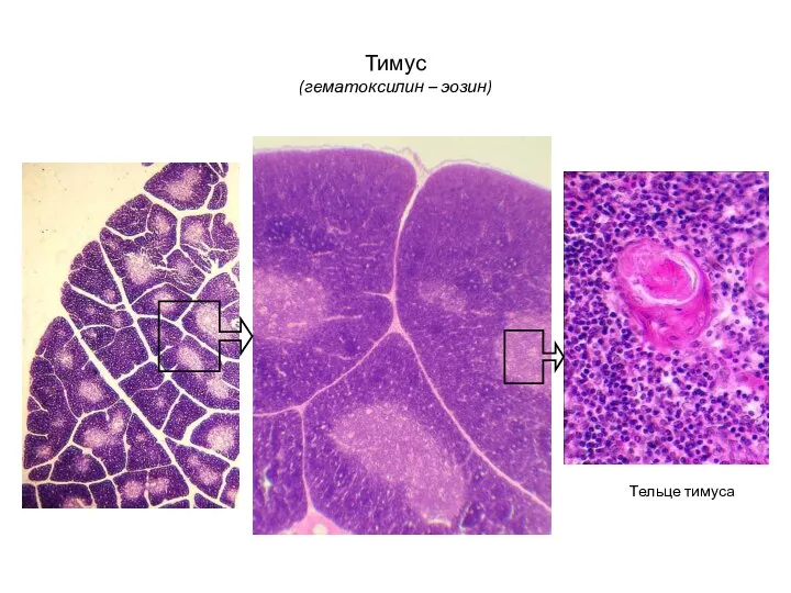Тимус (гематоксилин – эозин) Тельце тимуса