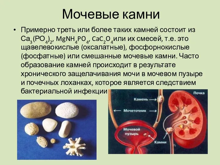 Примерно треть или более таких камней состоит из Са3(РО4)2, MgNH4PO4, CaC2O4или