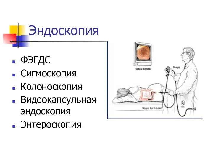 Эндоскопия ФЭГДС Сигмоскопия Колоноскопия Видеокапсульная эндоскопия Энтероскопия