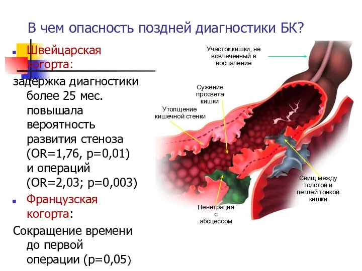 В чем опасность поздней диагностики БК? Швейцарская когорта: задержка диагностики более