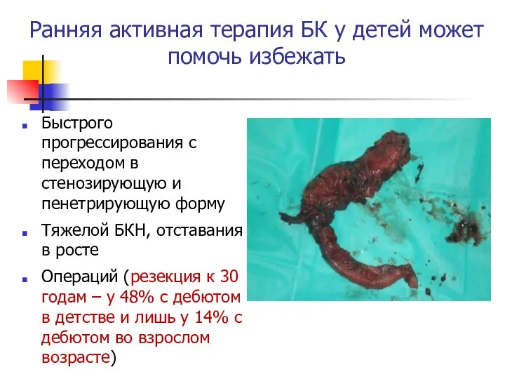 Ранняя активная терапия БК у детей может помочь избежать Быстрого прогрессирования