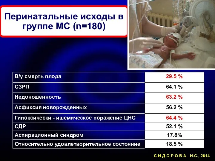 Перинатальные исходы в группе МС (n=180)