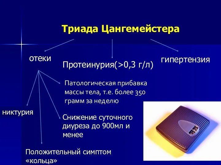 Триада Цангемейстера отеки Протеинурия(>0,3 г/л) гипертензия Патологическая прибавка массы тела, т.е.