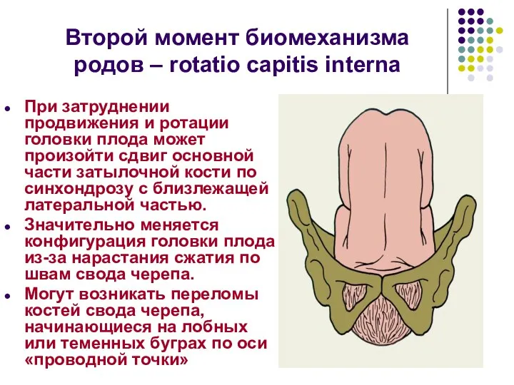 Второй момент биомеханизма родов – rotatio capitis interna При затруднении продвижения