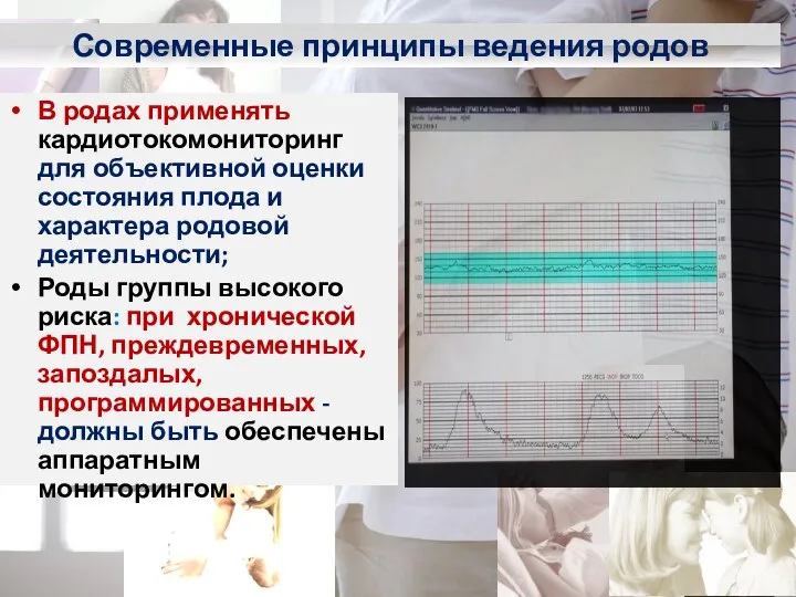 Современные принципы ведения родов В родах применять кардиотокомониторинг для объективной оценки