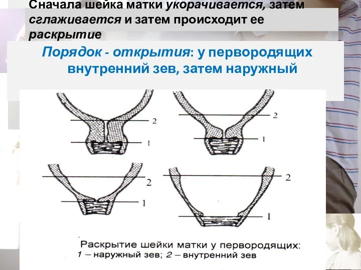 Сначала шейка матки укорачивается, затем сглаживается и затем происходит ее раскрытие