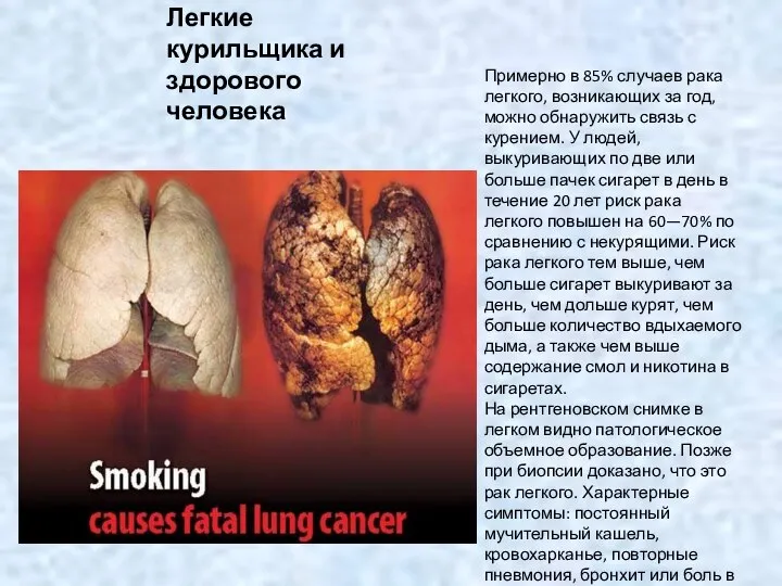 Легкие курильщика и здорового человека Примерно в 85% случаев рака легкого,