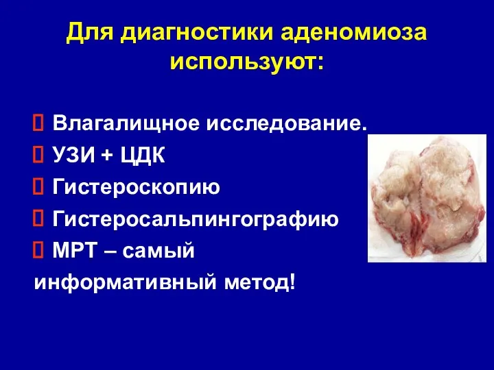 Для диагностики аденомиоза используют: Влагалищное исследование. УЗИ + ЦДК Гистероскопию Гистеросальпингографию МРТ – самый информативный метод!