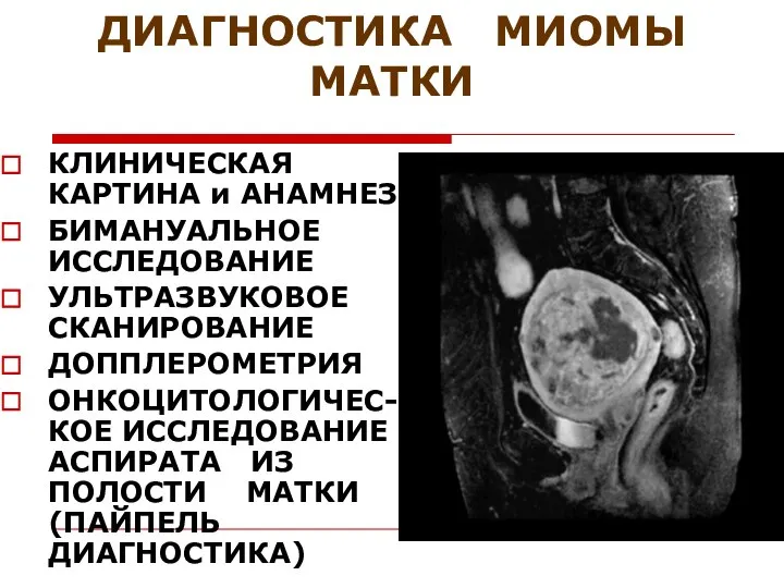 ДИАГНОСТИКА МИОМЫ МАТКИ КЛИНИЧЕСКАЯ КАРТИНА и АНАМНЕЗ БИМАНУАЛЬНОЕ ИССЛЕДОВАНИЕ УЛЬТРАЗВУКОВОЕ СКАНИРОВАНИЕ