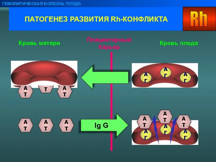 ПАТОГЕНЕЗ РАЗВИТИЯ Rh-КОНФЛИКТА ГЕМОЛИТИЧЕСКАЯ БОЛЕЗНЬ ПЛОДА Плацентарный барьер Кровь плода Кровь