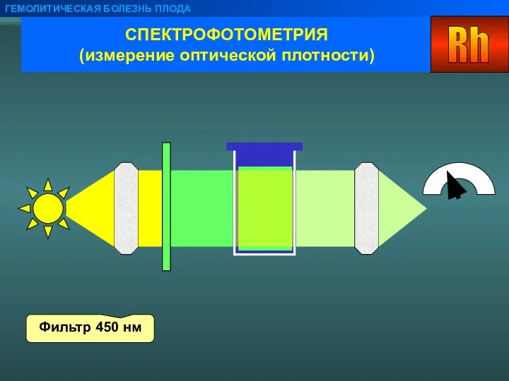 СПЕКТРОФОТОМЕТРИЯ (измерение оптической плотности) ГЕМОЛИТИЧЕСКАЯ БОЛЕЗНЬ ПЛОДА Фильтр 450 нм