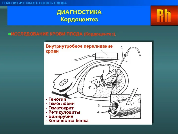 ДИАГНОСТИКА Кордоцентез ГЕМОЛИТИЧЕСКАЯ БОЛЕЗНЬ ПЛОДА ИССЛЕДОВАНИЕ КРОВИ ПЛОДА (Кордоцентез). - Генотип