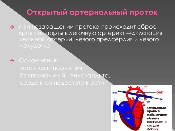 Открытый артериальный проток при незаращении протока происходит сброс крови из аорты